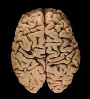 Photo cerveau vu du haut